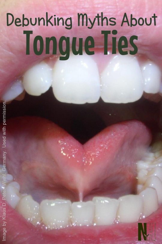 Debunking Myths About Tongue Ties Naturally, Holistically Healthy
