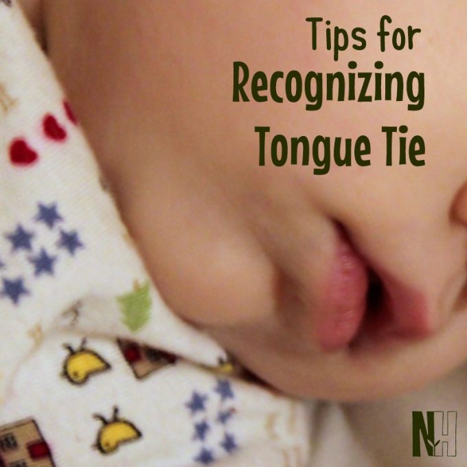Tips for Recognizing Tongue Tie